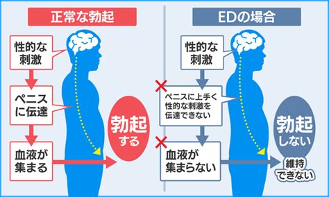 勃 た ない 原因|ED（勃起不全）とは？具体的な症状や4つの原因を解説【医師監 .